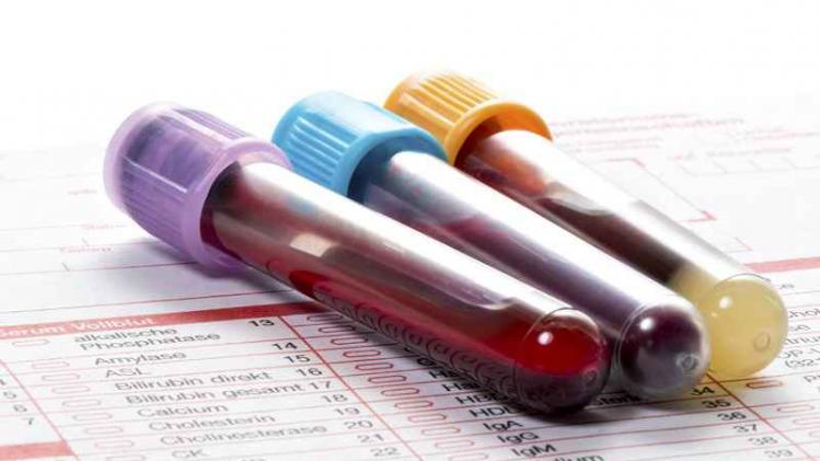 Blood test, blood samples on a laboratory form