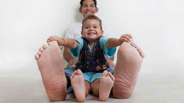 Jeison-Rodriquez-Largest-Feet-main_tcm25-395645