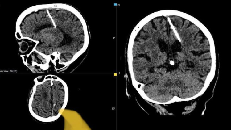 Baby born with 26 fingers and toes hailed as ‘reincarnation of Hindu goddess