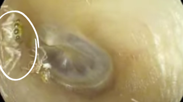 Baby born with 26 fingers and toes hailed as ‘reincarnation of Hindu goddess