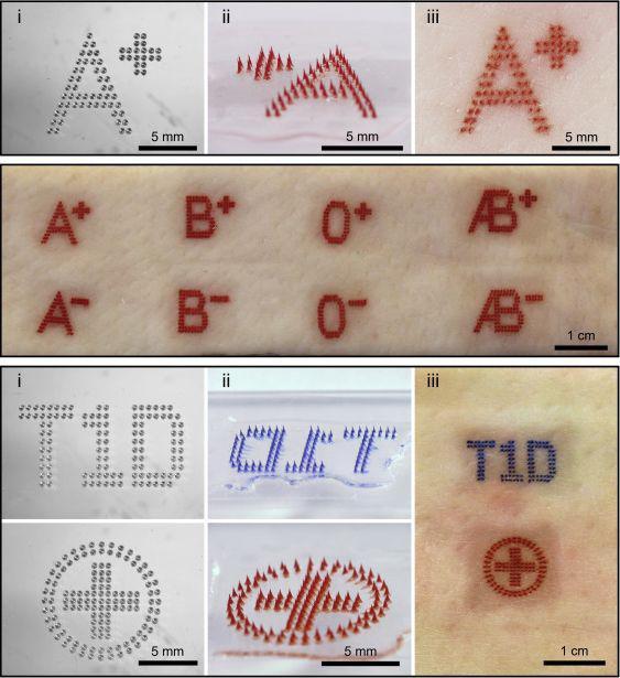 Medical_tattoos_by_MN_patches_280bdce6c6