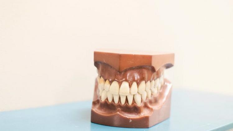 Drie zaken die slecht zijn voor je tanden