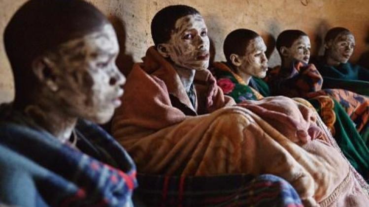 Minstens 18 jonge mannen gestorven in besnijdeniskampen in Zuid-Afrika