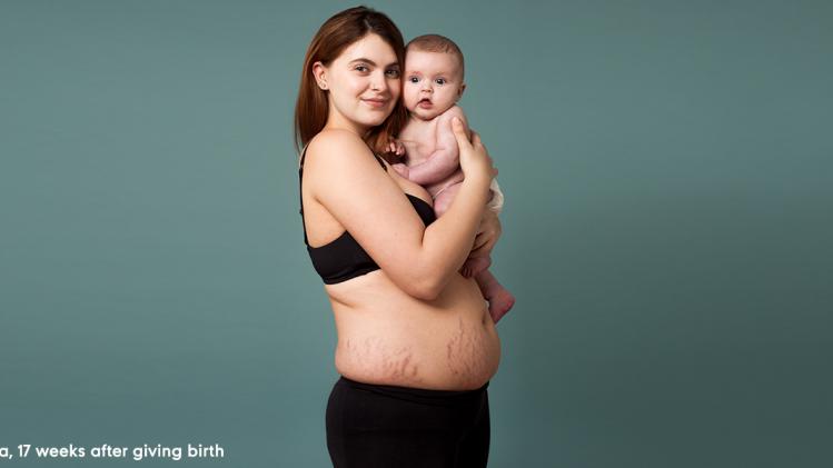 IN BEELD. Eerlijke beelden van vrouwen na hun bevalling