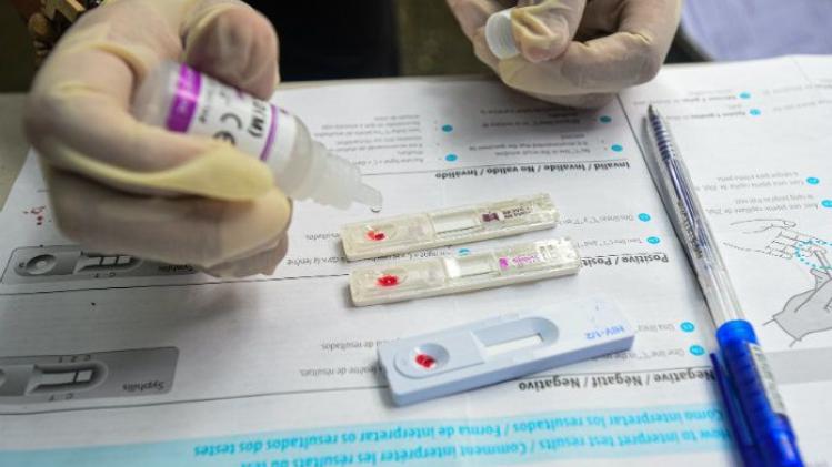 Genezing aids komt stap dichterbij: hiv-restvirus gelokaliseerd