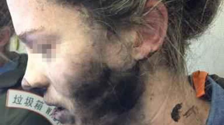 Koptelefoon van Australische vrouw ontploft tijdens de vlucht