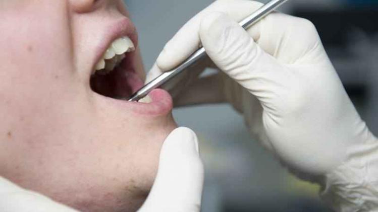 Slechte tanden zijn geen kwestie van genen, zo zeggen onderzoekers