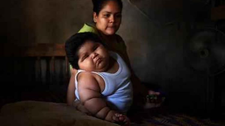 Mexicaanse baby van tien maanden weegt 28 kilo
