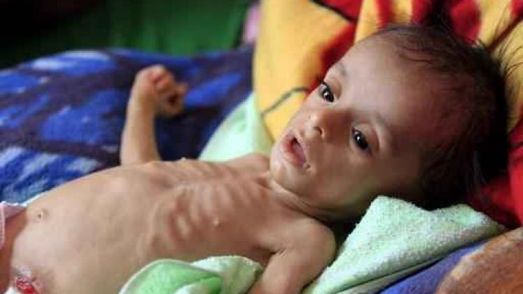 Ruim elf miljoen Jemenitische kinderen hebben dringend hulp nodig