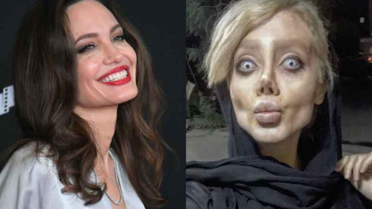 Sahar onderging 50 operaties om op Angelina Jolie te lijken. Oordeel zelf over het resultaat