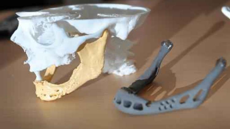 '3D geprinte implantaten niet aangetoond beter