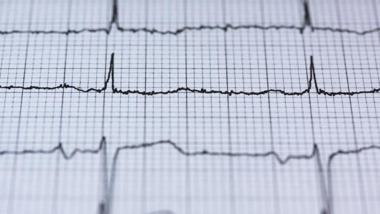 Deze tips helpen je een hartaanval te overleven