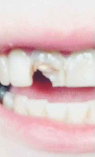 tandenn.jpg