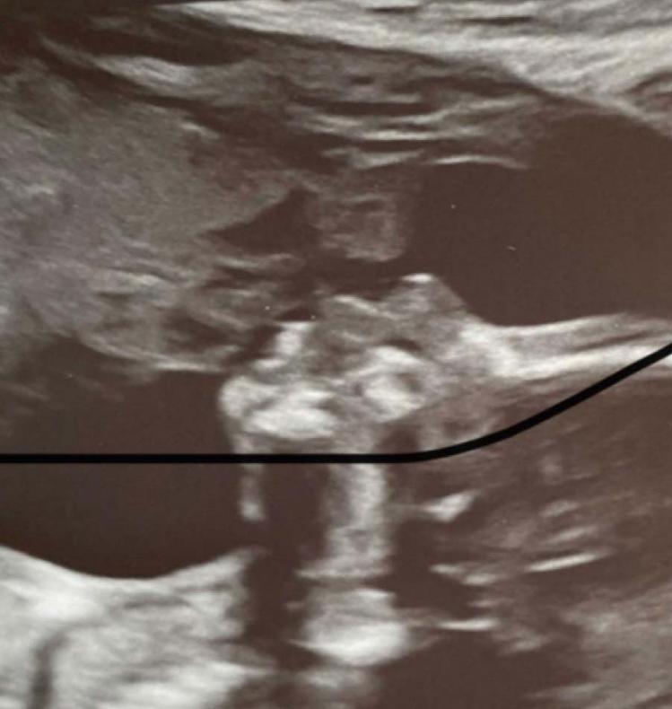 ultrasoundfoto1.jpg