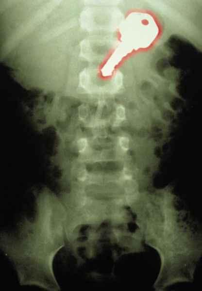 X-Rays-6.jpg